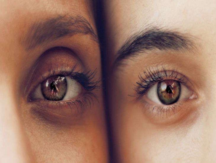 So entfernen Sie dunkle Ringe unter den Augen: Tipps, die Frauen helfen Augen