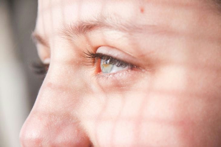 So werden Sie dunkle Augenringe los Auge